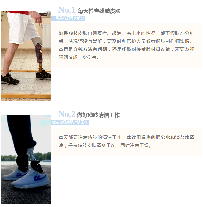 夏日炎炎，穿假肢出現(xiàn)悶熱多汗的情況，這8個(gè)知識(shí)點(diǎn)要了解