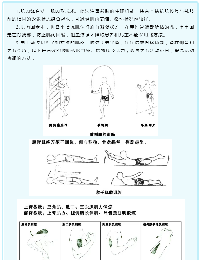 截肢綜論